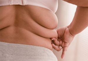 چین های چربی در طرفین